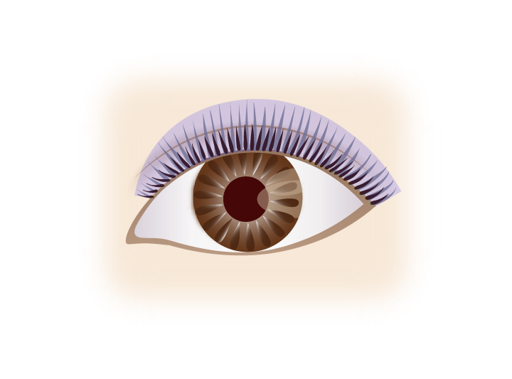 アイデザイン装着